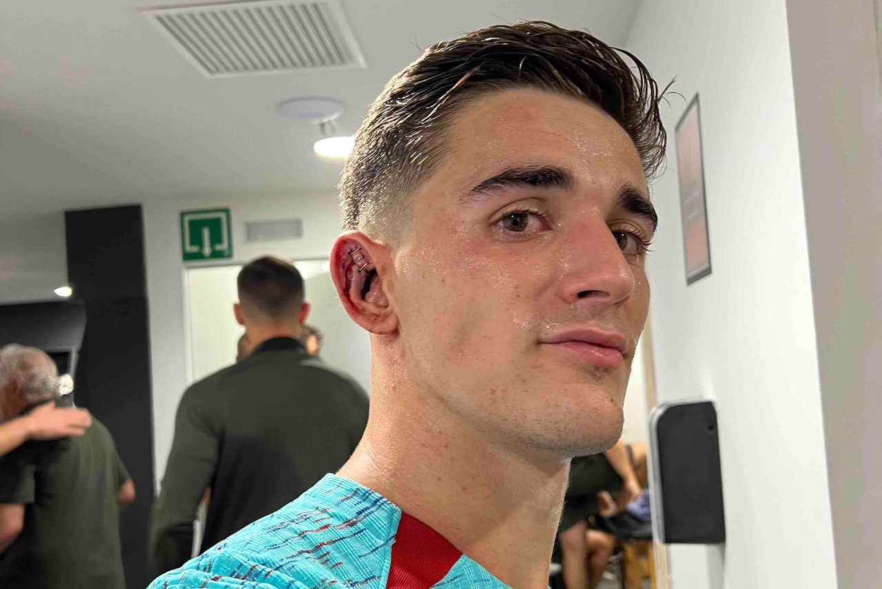 Gavi com a orelha machucada