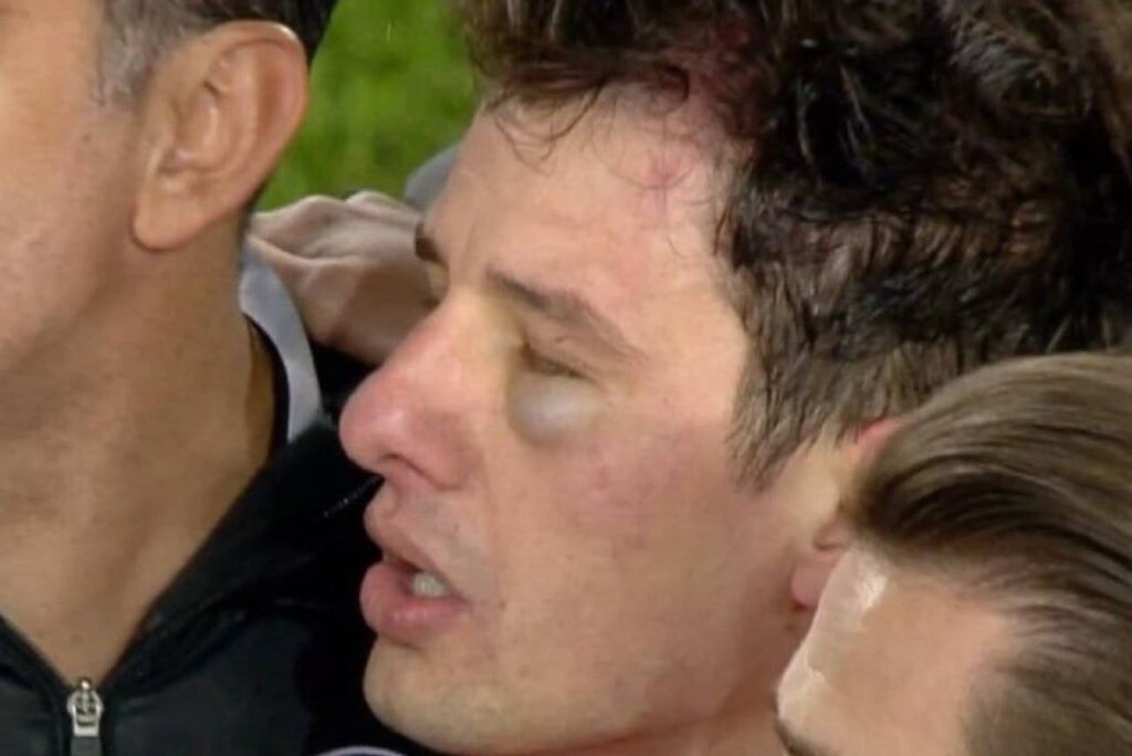 Árbitro foi agredido na Turquia