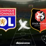 Lyon x Rennes