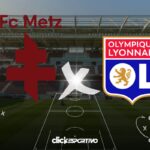 Metz x Lyon
