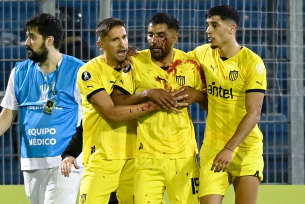 Maxi Olivera após ser agredido por torcedores do Rosario Central